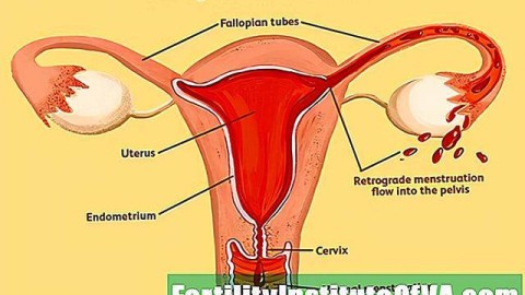 印度公司推出带薪月经假：真能打破经期污名化吗？